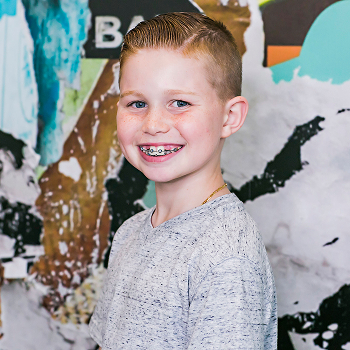 The American Association of Orthodontists recommends children get their first check-up with  an orthodontist no later than age 7.
